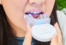 Best At Home Teeth Whitening Kits