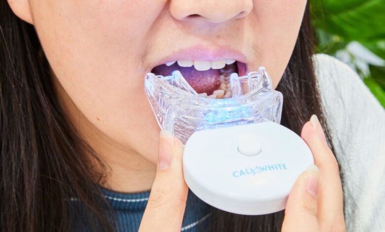 Best At Home Teeth Whitening Kits